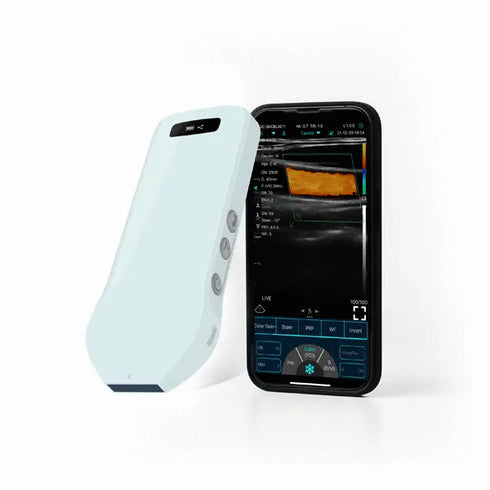 Ecograf ultraportabil wireless C10CS, liniar