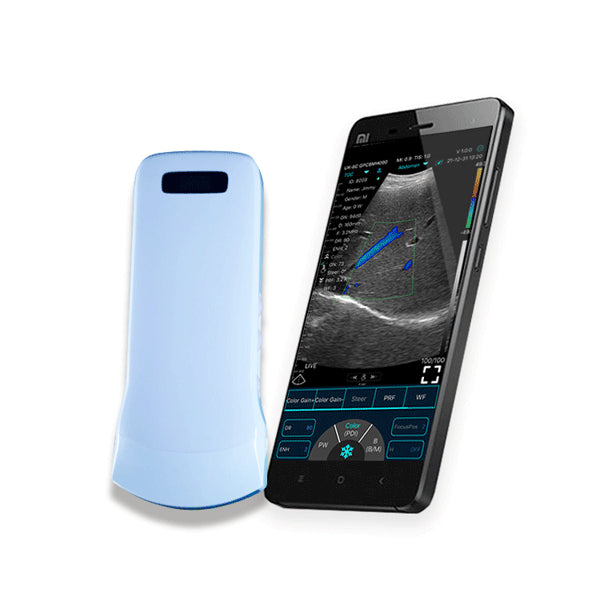 Ecograf ultraportabil wireless C10CT, convex