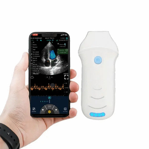 Ecograf ultraportabil wireless C10CW, cardiologie