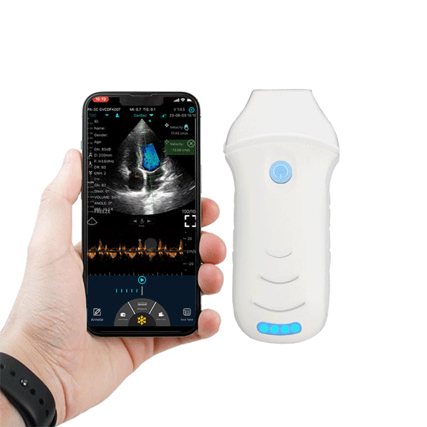 Ecograf ultraportabil wireless C10CW, cardiologie