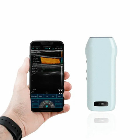 Ecograf ultraportabil wireless C10CX, liniar
