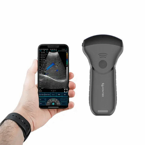 Ecograf ultraportabil wireless C10MT, convex