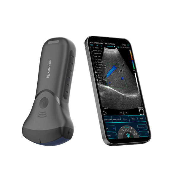 Ecograf ultraportabil wireless C10MT, convex