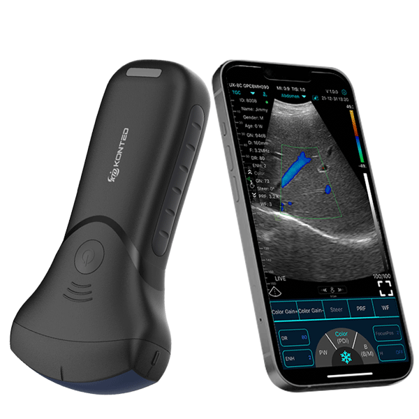 Ecograf ultraportabil wireless C10MTpro, convex