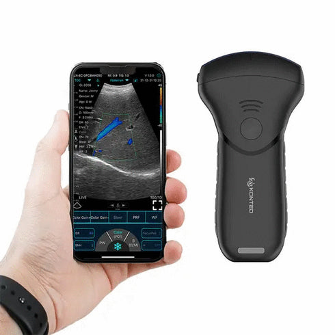 Ecograf ultraportabil wireless C10MTpro, convex