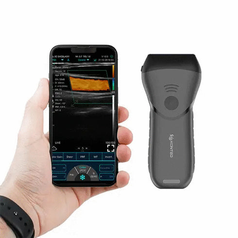 Ecograf ultraportabil wireless C10MX, liniar