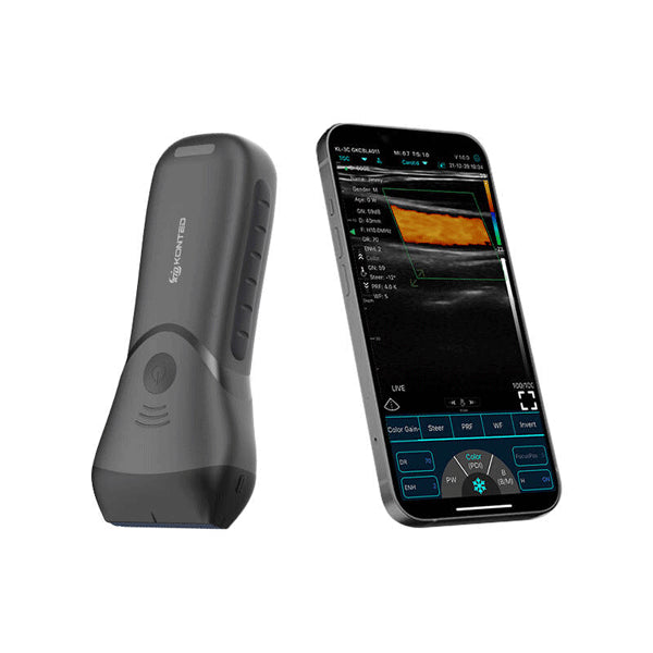 Ecograf ultraportabil wireless C10MX, liniar