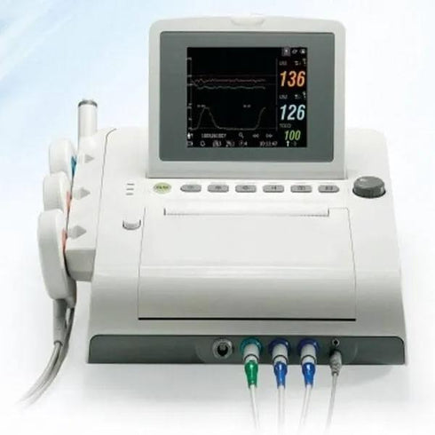 Monitor fetal F3