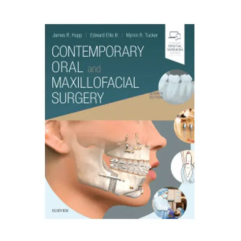 Contemporary Oral and Maxillofacial Surgery
