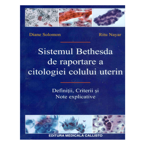 Sistemul Bethesda de Raportare a Citologiei Colului Uterin | medizone.ro