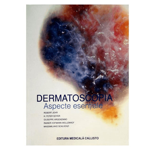 Dermatoscopie, Aspecte Esentiale | medizone.ro