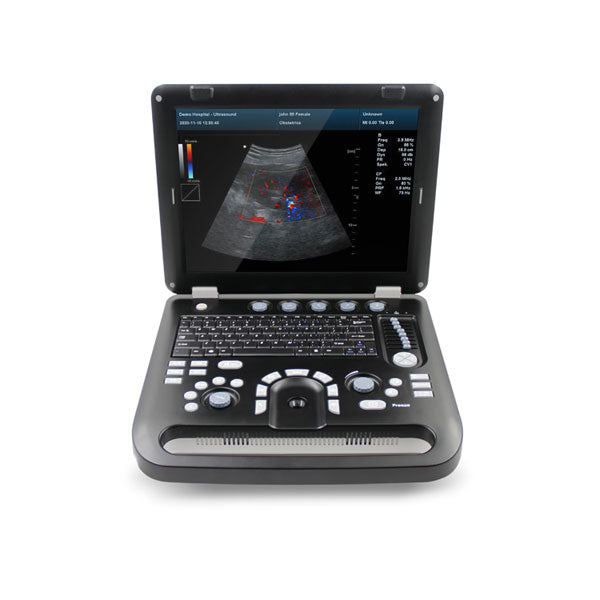Ecograf doppler color portabil CMS1700C
