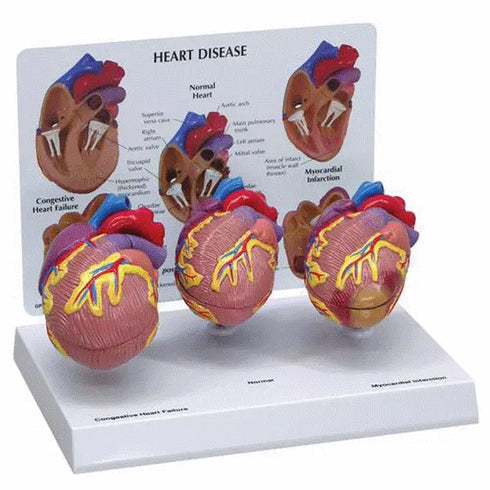 Set 3 mini modele inima umana