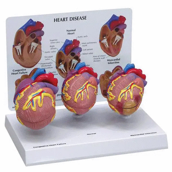Set 3 mini modele inima umana