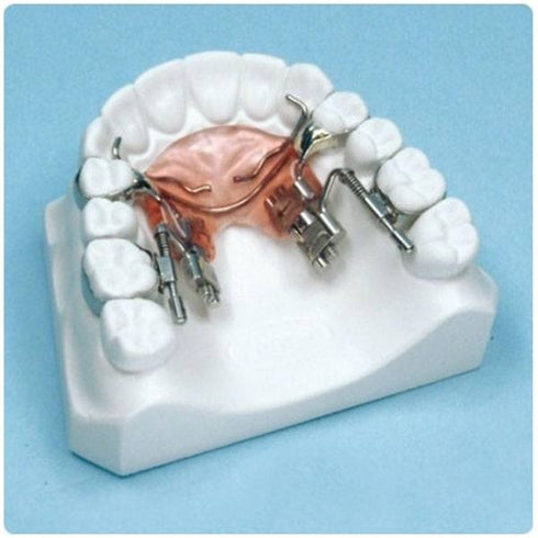 Kit distalizare molari superiori Fast Back Leone | medizone.ro