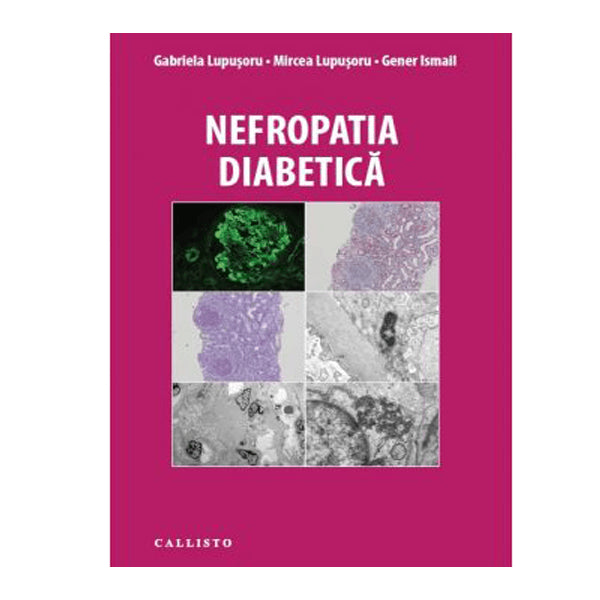 Nefropatia diabetica | medizone.ro