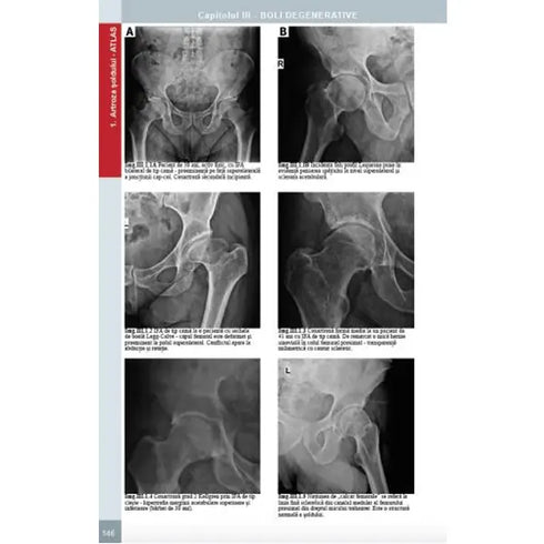 Radiologie musculo-scheletica, diagnostic complex prin radiologie clasica, ecografie si CT