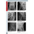 Radiologie musculo-scheletica, diagnostic complex prin radiologie clasica, ecografie si CT