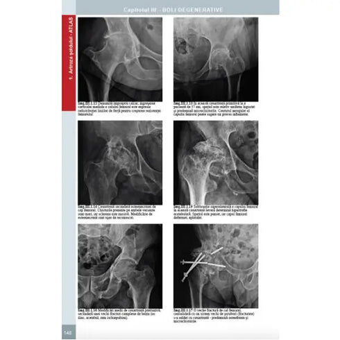 Radiologie musculo-scheletica, diagnostic complex prin radiologie clasica, ecografie si CT