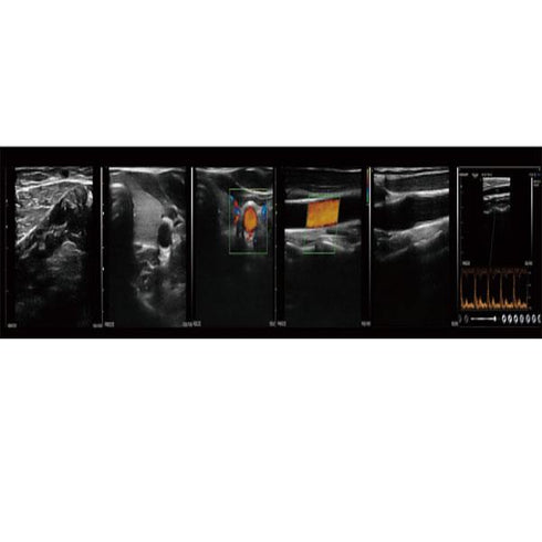 Ecograf ultraportabil wireless C10L45/L25 by Konted