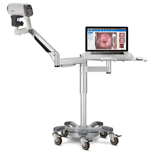 Videocolposcop C6A HD Edan
