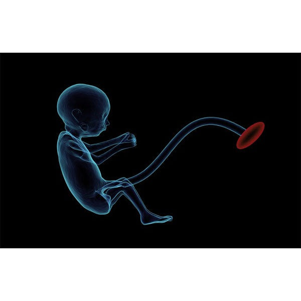 A fost creat primul uter artificial, care are potențialul de a scădea rata mortalității în rândul copiilor născuți prematur