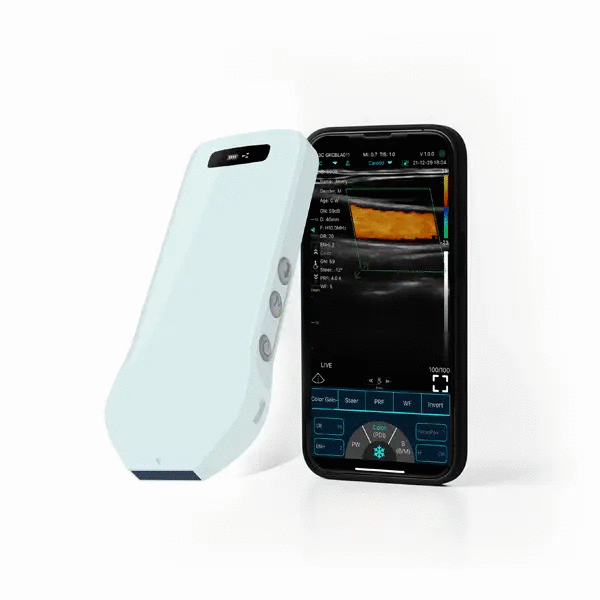 Ecograf ultraportabil wireless C10CS, liniar