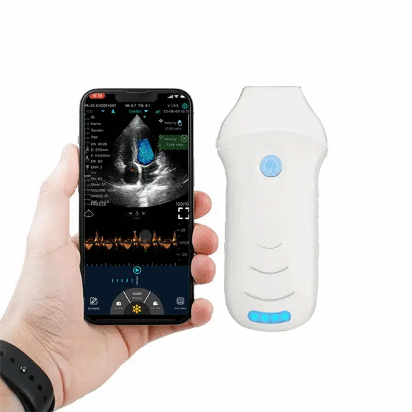 Ecograf ultraportabil wireless C10CW, cardiologie