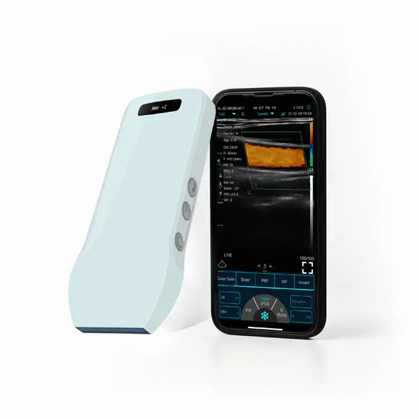 Ecograf ultraportabil wireless C10CX, liniar