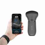 Ecograf ultraportabil wireless C10MT, convex