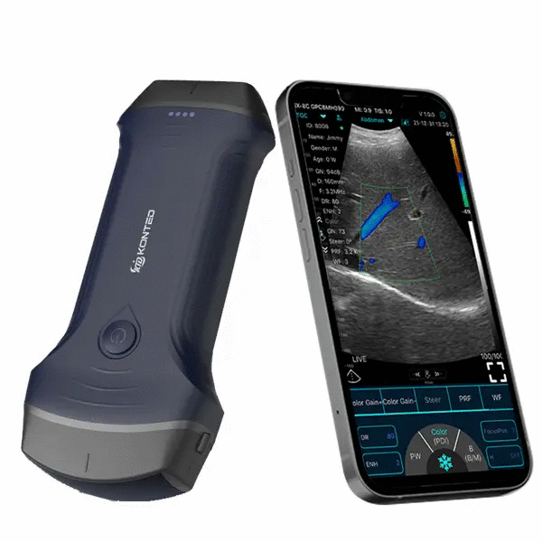 Ecograf ultraportabil wireless C10RLpro, convex si liniar