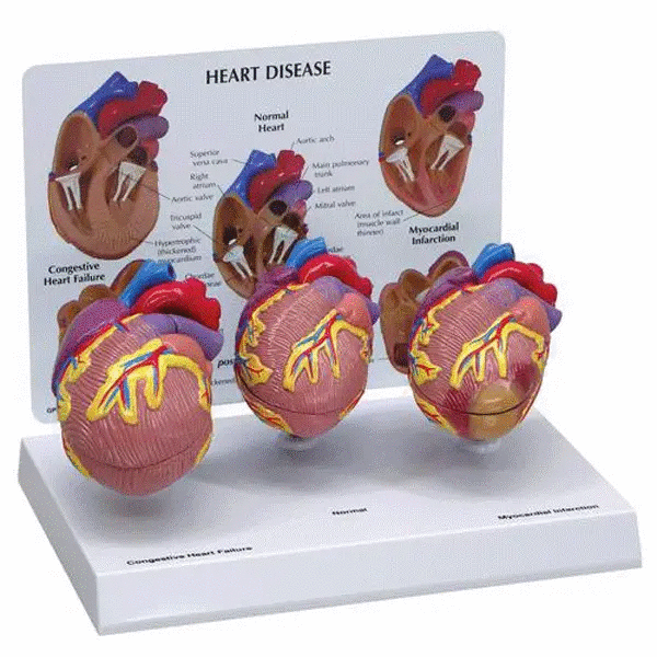 Set 3 mini modele inima umana