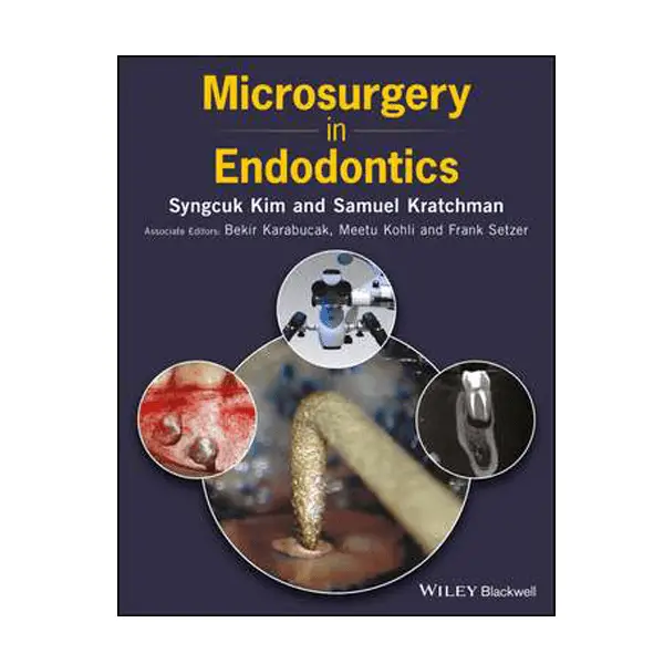Microsurgery in Endodontics