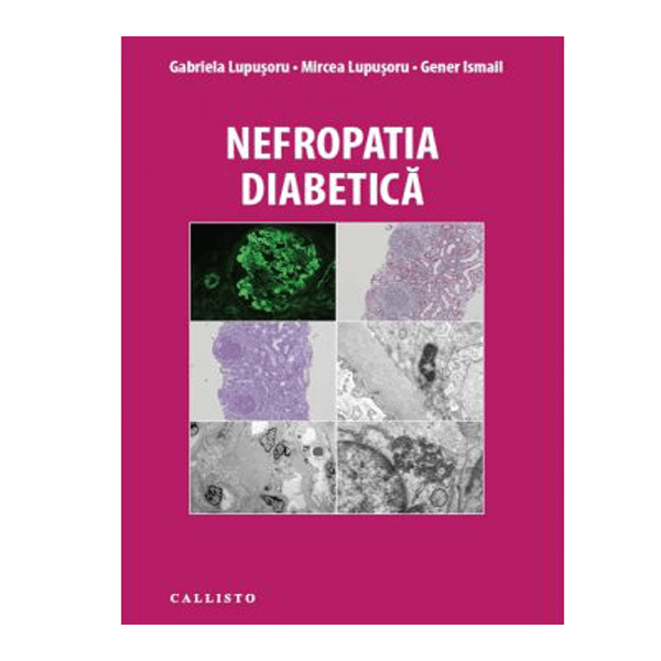 Nefropatia Diabetica