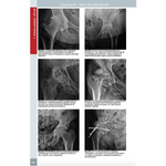 Radiologie musculo-scheletica, diagnostic complex prin radiologie clasica, ecografie si CT
