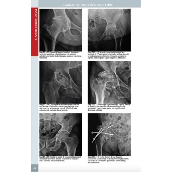 Radiologie musculo-scheletica, diagnostic complex prin radiologie clasica, ecografie si CT