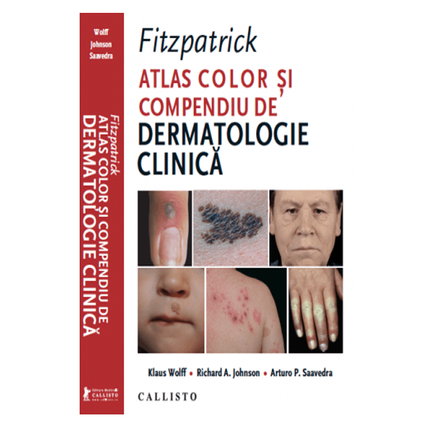 Fitzpatrick, Atlas Color si Compendiu de Dermatologie Clinica | medizone.ro