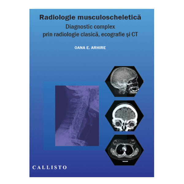 Radiologie musculo-scheletica | medizone.ro