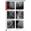 Radiologie musculo-scheletica, preview 1 | medizone.ro